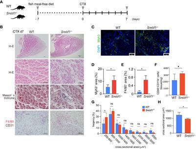 Macrophage SREBP1 regulates skeletal muscle regeneration